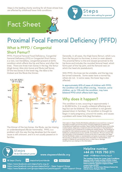 Proximal Femoral Focal Deficiency Congenital Short Femur - STEPS Charity