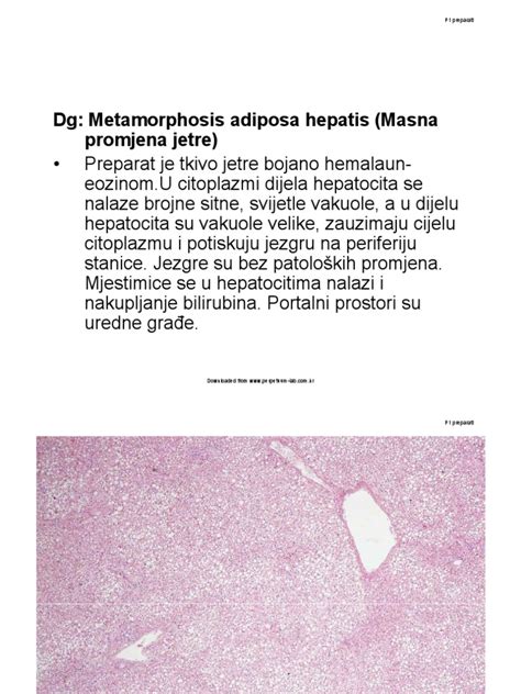 PATOLOGIJA - Slike I Opis Preparata | PDF