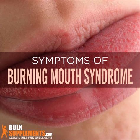 What Causes Burning Lips Sensation | Lipstutorial.org