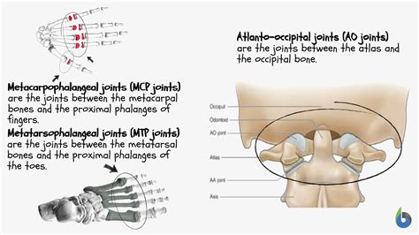 Condyloid Joint