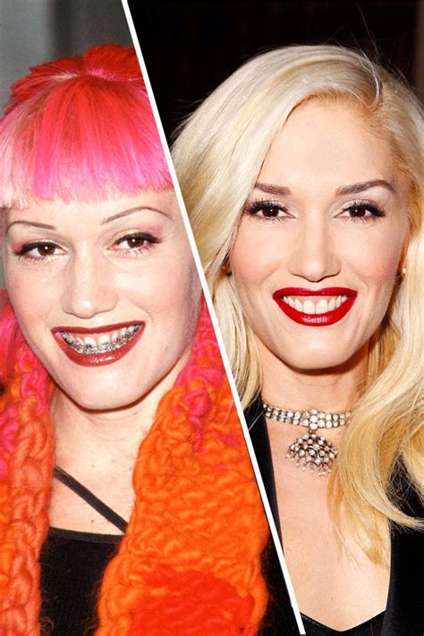 Look How Gwen Stefani’s Plastic Surgery has Helped Her Shift from Grunge to Glam | ENC