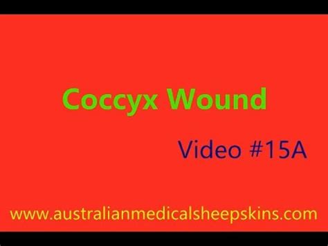 Part 1 Coccyx Wound (15A) - YouTube