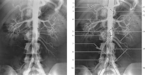 and Veins | Radiology Key