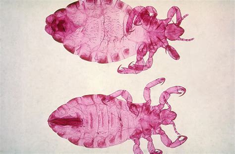 Body Louse Leg, Lm Photograph by AFIP/Science Source - Pixels