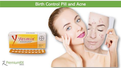 Birth Control Pill and Acne | PremiumRx- Online Pharmacy