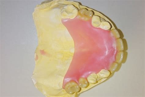 Acrylic Partial Dentures - Available at Cavan Denture Clinic