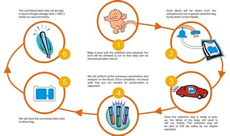 Umbilical-Cord Stem Cell Banking Procedure Cost Pros & Cons - Trends and Health