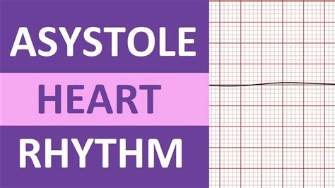 Asystole Heart Rhythm ECG Causes, Treatment Nursing NCLEX Review EKG ...