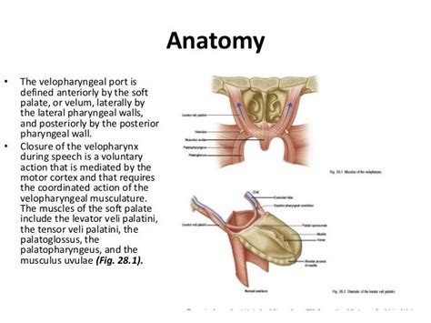 Velopharyngeal dysfunction (VPD)