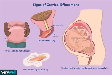 Cervical Effacement: Causes, Measuring What It Means, 51% OFF