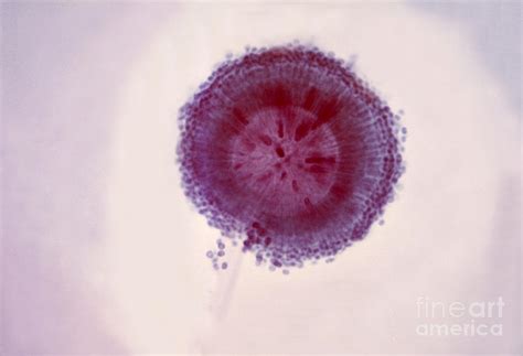 Aspergillus Niger Photograph by Science Source