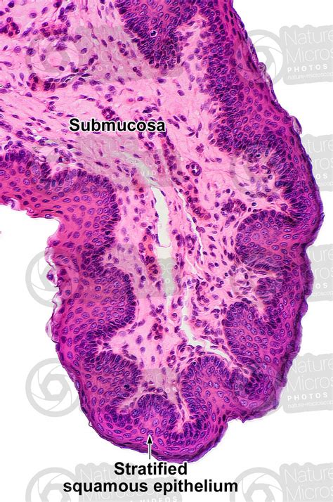 Epiglottis Histology Labeled