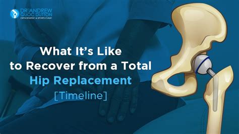 Total Hip Replacement Recovery [Timeline] | Dr Andrew Dutton