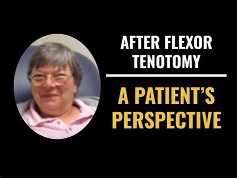 1st visit after flexor tenotomy by Dr Pelto - YouTube