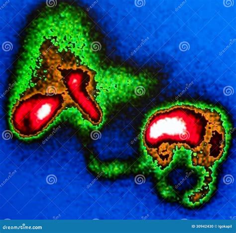 Liver,gallbladder,intestine Nuclear Scan Stock Photo - Image of doctor, filling: 30942430