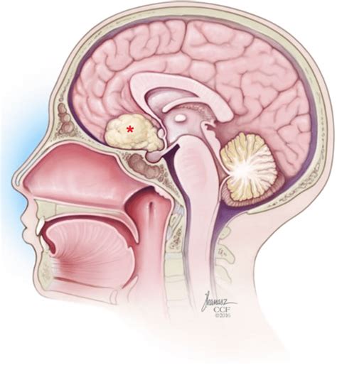 Planum Sphenoidale Anatomy