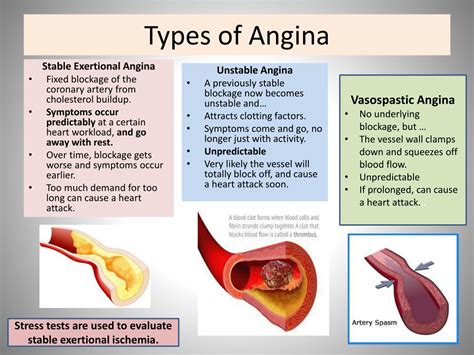Angina System Disorder Template