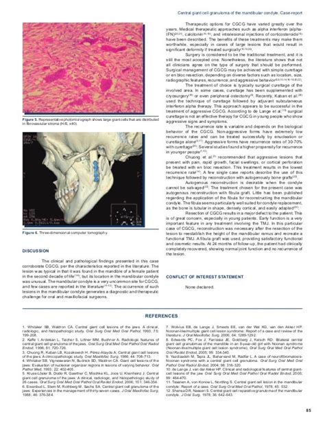 CENTRAL GIANT CELL GRANULOMA