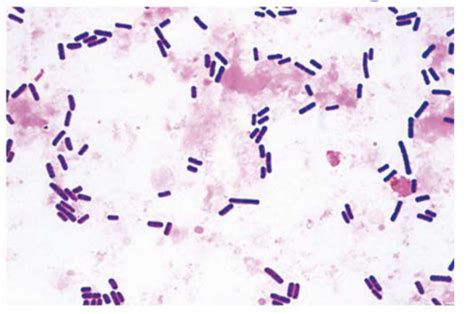 Clostridium Perfringens Gram Stain