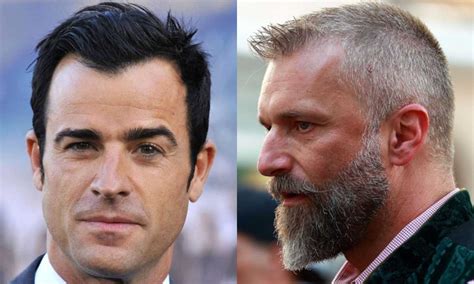 Balding? 8 Best Men's Hairstyles For Thinning Hair - Too Manly