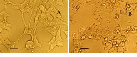 Morphology of MCF-7 cells before (a) and after (b) exposure to ...