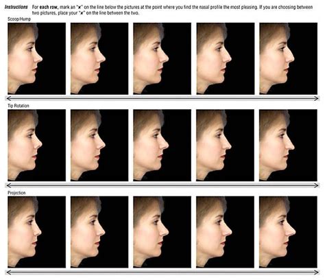 Nose Types | Nose shapes, Face and body, Nose job