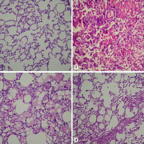 a) Histological examination of lung tissue of Group 1. Normal pulmonary... | Download Scientific ...