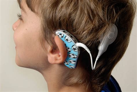 Cochlear Implant Debate – What Side Are You On? | English 214.43 Blog