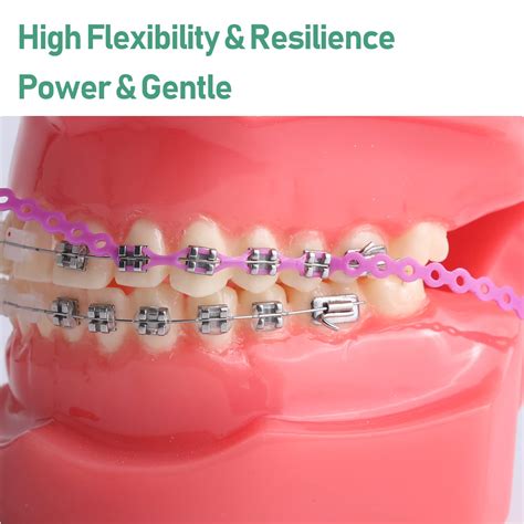 Orthodontic Power Chain | ubicaciondepersonas.cdmx.gob.mx