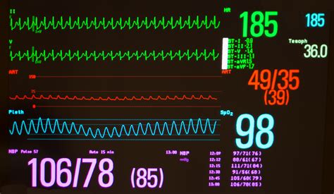 What is Tachycardia, Symptoms, and Treatment | Pulse Cardiology