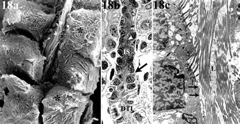 Microanatomy and ultrastructure of the kidney of the African lungfish ...