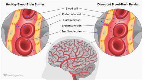 Blood-Brain Barrier: Definition, Related Conditions, and More