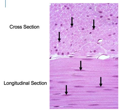 Cardiac Muscle Histology Cross Section