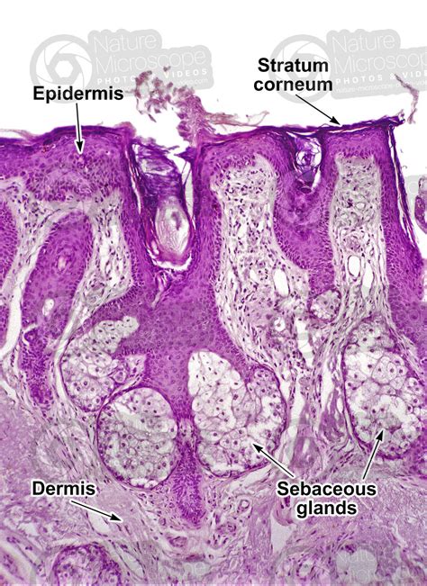 Sebaceous Glands Histology