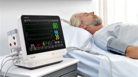 Advanced Patient Monitoring - Mindray