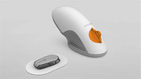 Equities Analysts Decrease Earnings Estimates for DexCom, Inc. (DXCM) - Equity Insider