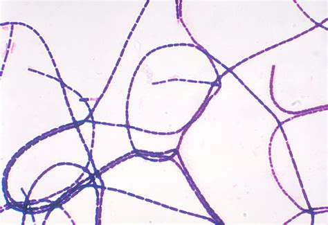 Streptococcus Bacteria Gram Stain