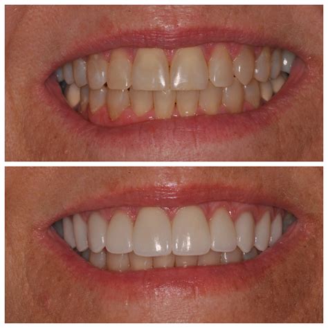 Smile Spotlight: Ann | The Health Benefits of Smiling