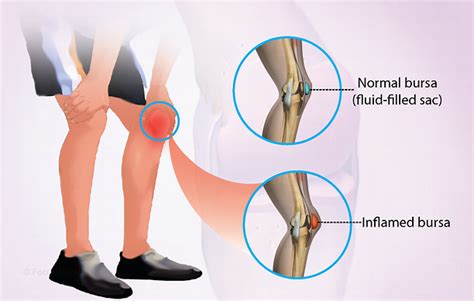 Health Condition : Symptoms, Causes, Treatment and More