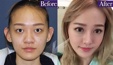 Korean Idol Plastic Surgery – Telegraph