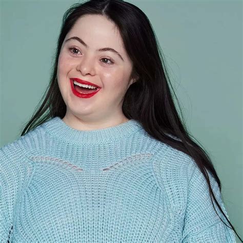 First Down’s syndrome model Ellie Goldstein who campaigned for Gucci- The Etimes Photogallery ...