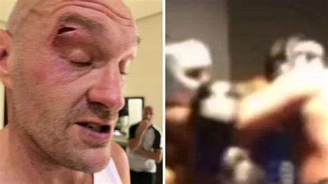 Tyson Fury's sparring partner opens up on freak accident that delayed ...