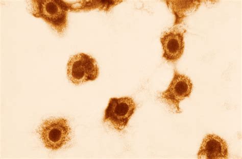 Study: Cytomegalovirus Infection May Enhance Immune System | Sci.News