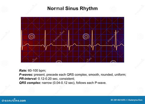 A Normal Electrocardiogram, 3D Illustration Stock Illustration - Illustration of black, medical ...