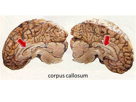 Thoughts on Consciousness and the Corpus Callosum — Joe's Notes