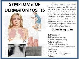 Dermatomyositis and Polymyositis Autoimmune Disorder | ARAPC