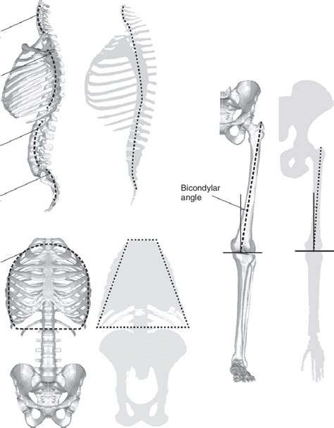 Bipedalism Spine