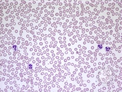 Normal peripheral blood smear