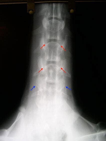 What Is Wobblers Disease In Dogs