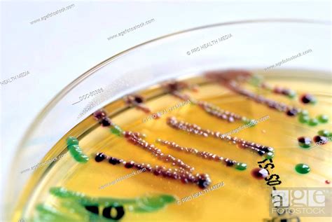 Culture of E.coli and enterobacter cloacae, Stock Photo, Picture And Rights Managed Image. Pic ...